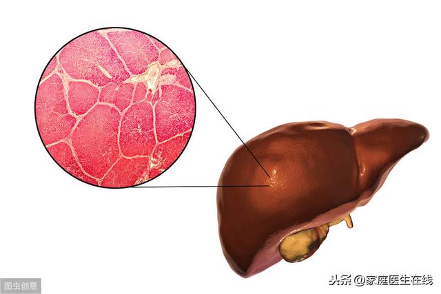 肝囊腫是怎麼形成的？應該怎麼飲食調理？文章給你講一講