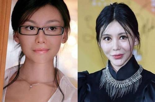 整容失敗有多可怕？看看這些娛樂圈女明星你就知道！