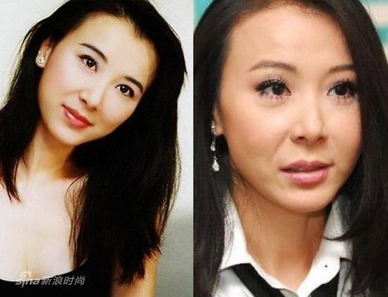 整容失敗有多可怕？看看這些娛樂圈女明星你就知道！