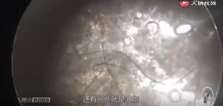 我們洗澡時搓下來的「鮮」到底是甚麼東西？在顯微鏡下放大100倍…瞬間解惑了！