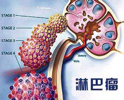 風水先生喝醉透漏：若是廁所放了此寶，窮人也能富三代