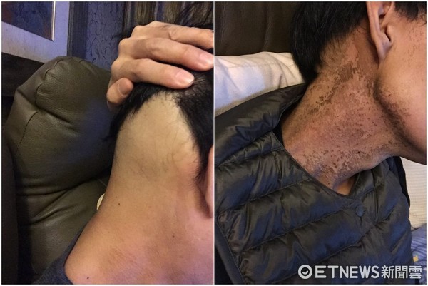 不放棄1%的機會！猛男CEO癌末操6塊肌　不讓自己像病人