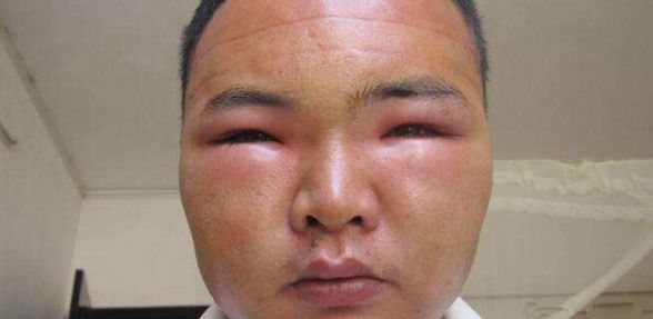 男子挖土隱約看到「金黃色」的物品，一伸手觸摸他隨即慘叫一聲…然後就被送醫了！