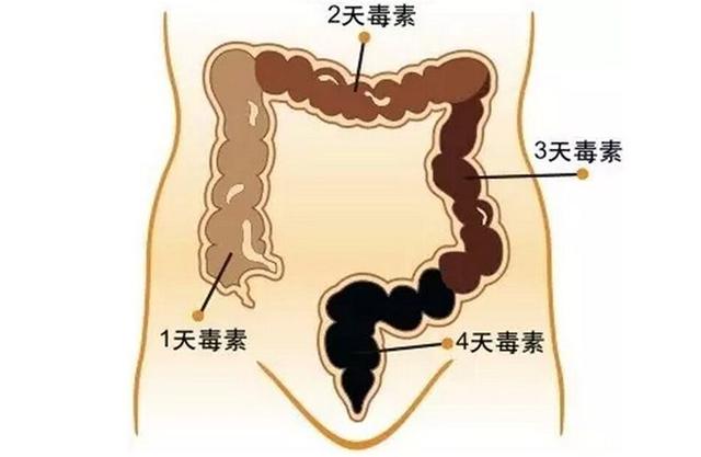 「大肚子」愛便秘！多吃這3種東西，排出多年黑臭便，肚子也平了