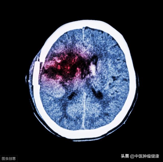 32歲男子，滴酒不沾，突發腦出血離世，醫生直言：妻子是&amp;quot;禍根&amp;quot;