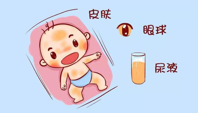 新生兒黃疸怎麼辦？看這一篇就夠！