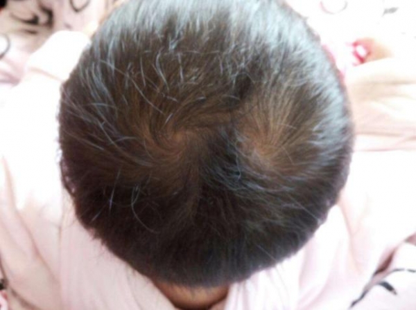 ﻿頭上有「2個旋」的寶寶，是性格更好還是命更好？孩子頭上的旋，都有什麼含義呢？