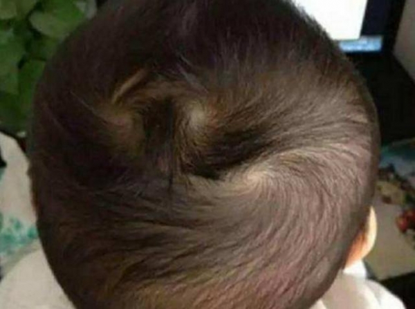 ﻿頭上有「2個旋」的寶寶，是性格更好還是命更好？孩子頭上的旋，都有什麼含義呢？
