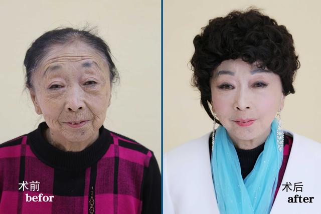 71歲阿嬤為了嫁給年輕帥哥，傾盡家財跑去「整型成30歲少婦」，變化超大！