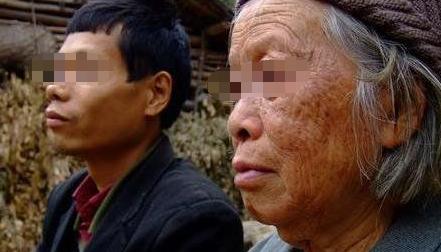 男子愛上71歲老太，為此老太整成少女，三年後，小夥直接傻了眼！
