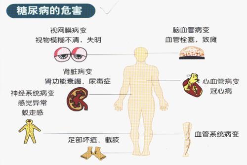 為什麼糖尿病容易引起血管併發症？高血糖觸發的蛋白可能是關鍵
