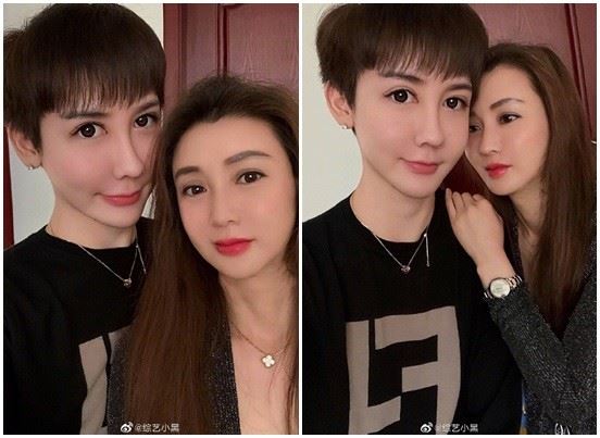蛇精男劉梓晨2年未出現，近照曝光，臉部嚴重變形網友：臉全毀了