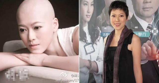 曾被曝只能活五年，43歲女星三天就被剃光頭，相戀7年男友不離不棄，9年後近照曝光，網友：雨過天晴