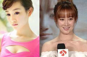 因為整容而把自己整毀的女明星