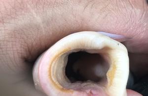 剛釣起來的野生大鯉魚，嘴裡卻有一堆「小黑蟲」，這還能吃嗎？