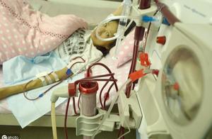 中國腎病患者1.2億人？遠離尿毒症，先要遠離3種食物