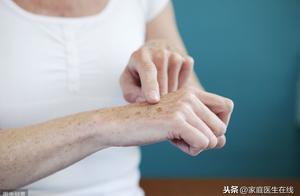 老年斑有沒有辦法預防？分享這幾個方法，不妨試一試