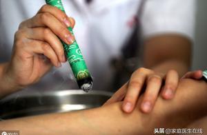 艾灸後出汗好不好？代表身體健康嗎？文章說一說