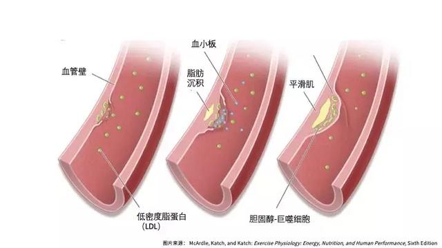 護心保命，這份飲食你一定不想錯過
