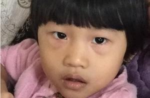4歲女童喝水進醫院，醫生提醒：3個時間段別給娃喝水
