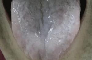 如何辨別寒濕體質和濕熱體質，該如何調理