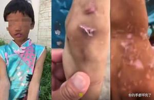 奶奶用老虎鉗教育孫女，讓人心疼：管教孩子你為什麼總會失控？