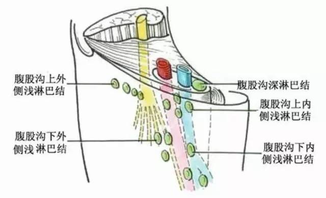 治婦科疾病的簡單療法——拍腹股溝