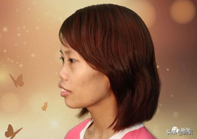 長得醜被罵到想輕生，換頭後逆襲成翻版高圓圓，讓人驚豔！