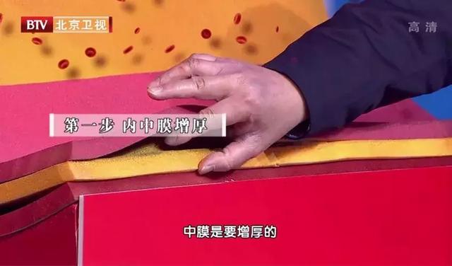 55歲體檢正常，三年後卻突發心梗？！醫生稱：你以為「煮」得很健康，其實都錯了！
