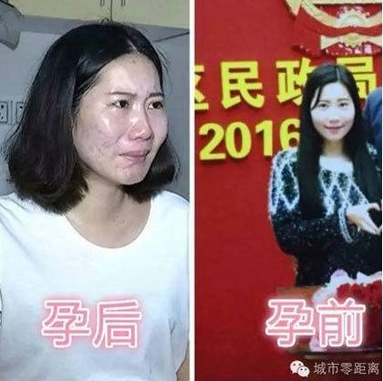 老婆懷孕五個月變醜，丈夫覺得好惡心離家出走！