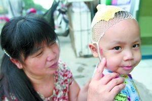 只因為小孫子在娘家玩耍時跌傷了，公公向自己的親家公要賠償